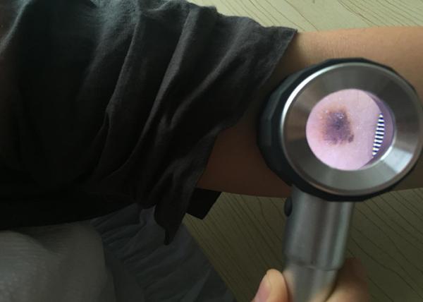 Customized Health Care Handheld Medical Dermatoscope Digital Video Otoscope For