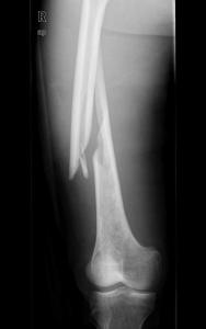 Wholesale Konida Laser X Ray Medical Imaging from china suppliers