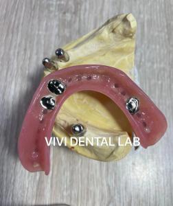 Wholesale Ni Be Free Dental Lab Crowns Telescopic Secondary Primary Teeth Crowns from china suppliers
