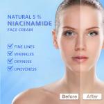 Nicotinamide Organic Face Cream Arbutin Night Bleaching Skin Lightening Cream