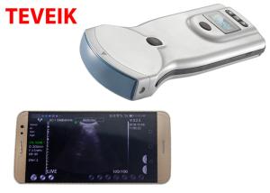 Wholesale Low Price Wireless Ultrasound Probe Mobile Gyne Ultrasound Machine from china suppliers