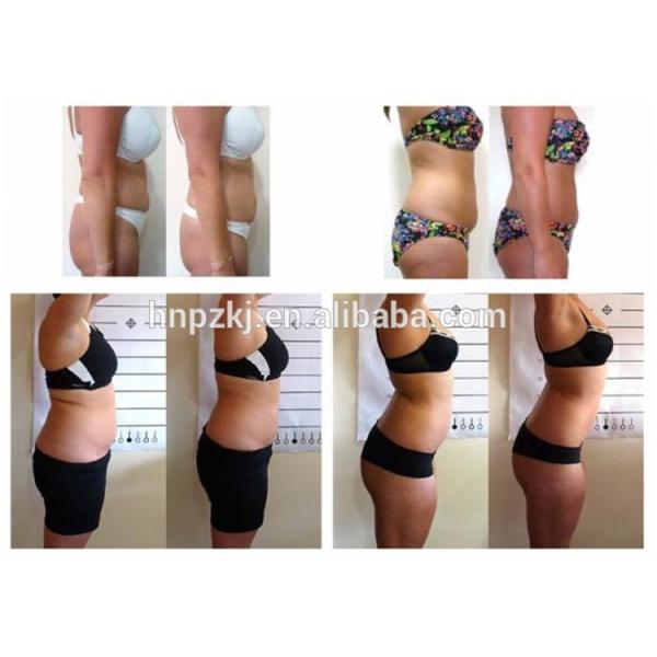 Radio Frequency Ultrasonic Liposuction Cavitation Slimming Machine 6 In 1 Type