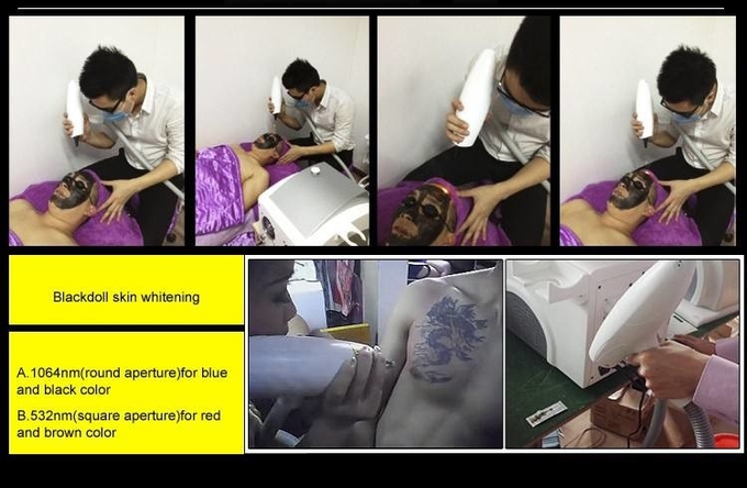 FDA 1064 Nm Pico Second Q Switched Nd Yag Laser For Skin Lightening