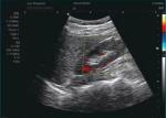 Portable Ultrasound Diagnostic Machine Laptop Probe Color Doppler Equipment