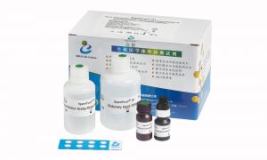 Wholesale Serum Assay Anti Mullerian Hormone Test Kit AMH CLIA Kit For Adult Females from china suppliers