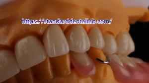 Wholesale Layered Dental Zirconia Crown And Bridge Translucency 3D PRO Zirconia Porcelain Crown Standard Dental Lab from china suppliers