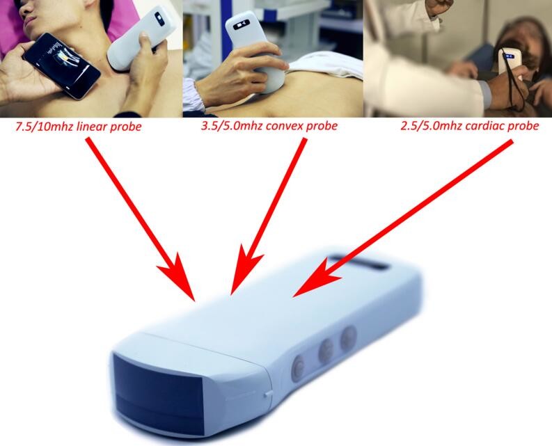 DICOM Medical Hospital Equipments 128 Element Portable Wifi Wireless Ultrasound Scanner
