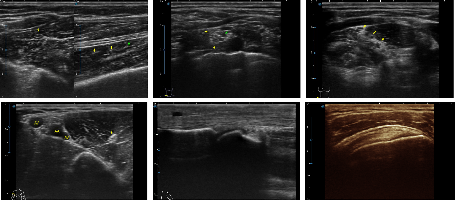 Sonoscape X5 Medical Ultrasound Instruments Machine with Excellent Image Quality