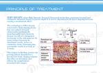 Most professional new technology ce approved BeiJing hifu weight loss machine