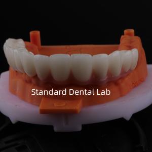 Wholesale Good Fitting Precise Esthetic Zirconia Porcelain Crown Pink Porcelian With Bleaching Shade from china suppliers