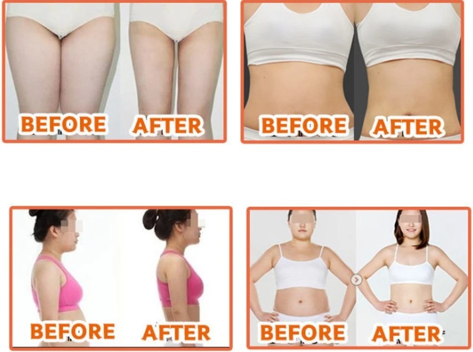 Hyamely Weight Loss Slimming Ppc Fat Dissolving Injections Lipolysis Solution