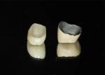 Highly Durable Restoration Porcelain Fused To Metal Crown For Natural Looking
