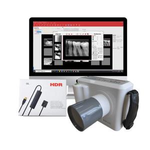 China Dental Radiology Digital X Ray Equipment Maquina Equipo De Rayos X Portatil on sale