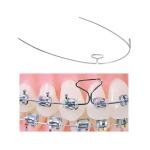Orthodontic Stainless Steel Bull Braces Loop Wire For Teeth Alignment And Dental