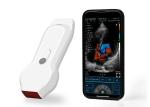 2.2MHz Mobile Portable Ultrasound Scanner Linear+Cardiac Probe 7.5/10MHz
