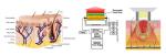 Elight + SHR for hair removal, skin rejuvenation, spots and acne removal