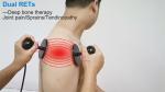 Smart Indiba 448khz 3 In 1 Ret Cet Tecar Physical Therapy Back Pain Relief RF