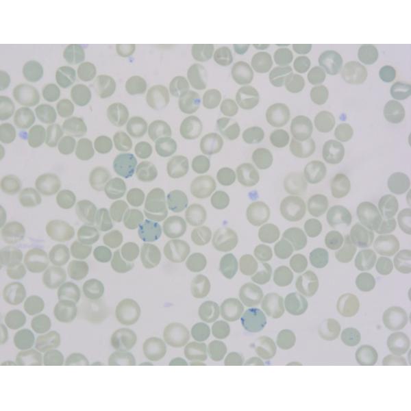 Basic Dye Reticulocyte Stain Solution 2x100mL 6x20mL For Scientific Research