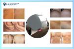 2016 NUbway Newest professional 808nm diode laser /diode laser hair removal/