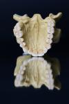 Dental Lab Porcelain Zirconia Dental Crown 5 Stars Esthetics