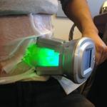 Double Channel cryolipolysis machine 4 handles Lipo Suction Cryo Freeze Fat Loss
