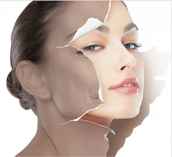 IPL ICE SHR SSR Hair Removal Skin Rejuvenation Pigmentation&Vascular&Acne&Spot Removal Beauty Salon Equipment&Machine