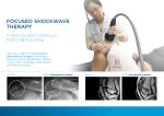 10 bar focused Gainswave Ed ESWT Low Intensity Shockwave Therapy Machine/pain