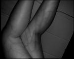 Infrared Light Source Vascular Light Vein Locator Device Reducing Venipuncture