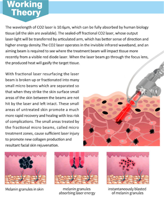 Effective Fractional Laser Co2 Machine For Vaginal Treatment