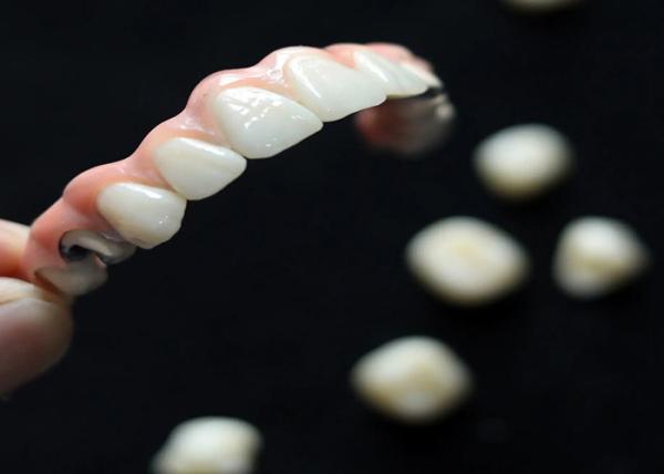 Aesthetic Solution Dental Implant Crown Bridge For Adults Replacing Missing