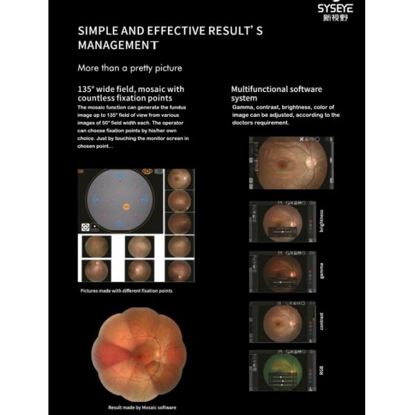 High Resolution Digital Fundus Camera Minimum Pupil 3.3mm Red Free (FFA)/(FAF)