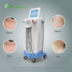 Wholesale For Blood Spider clearance 980nm Diode Laser Spider Vein Removal Machine from china suppliers