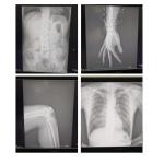 Medical X Ray Equipment High Frequency Digital Portable X-Ray Machine 900KJ Heat