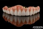 Long Lasting Titanium Bar Zirconia Hybrid Bridge Natural Looking Aesthetics For