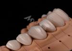 Strength Natural Esthetics Teeth Zirconia Crowns For Precise Fit Chip Resistance