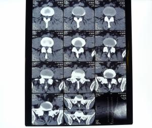 Wholesale Waterproof Holographic X Ray Dry Film KND-A For Thermal Printer , AGFA 5300 / 5500 / 5302 from china suppliers