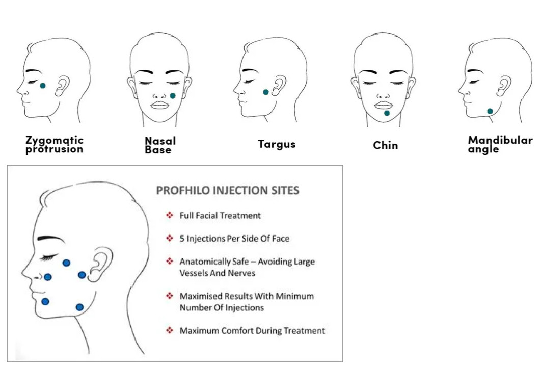 Profhilo Injections Ultimate H L Skin Booster For Deep Skin Hydration One Syringe Per Box