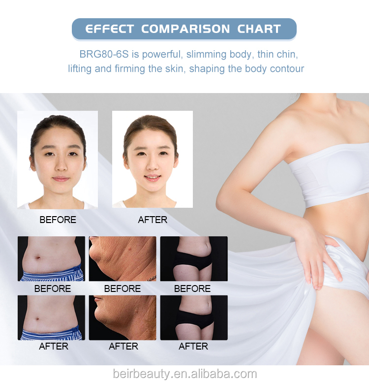 Multifunctional Vacuum Cavitation System With 4 Cryo Handles RF Fat Burning Machine