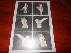 Wholesale High Sharpness Wearable Konida Medical Imaging Xray Paper For Laser Printer from china suppliers