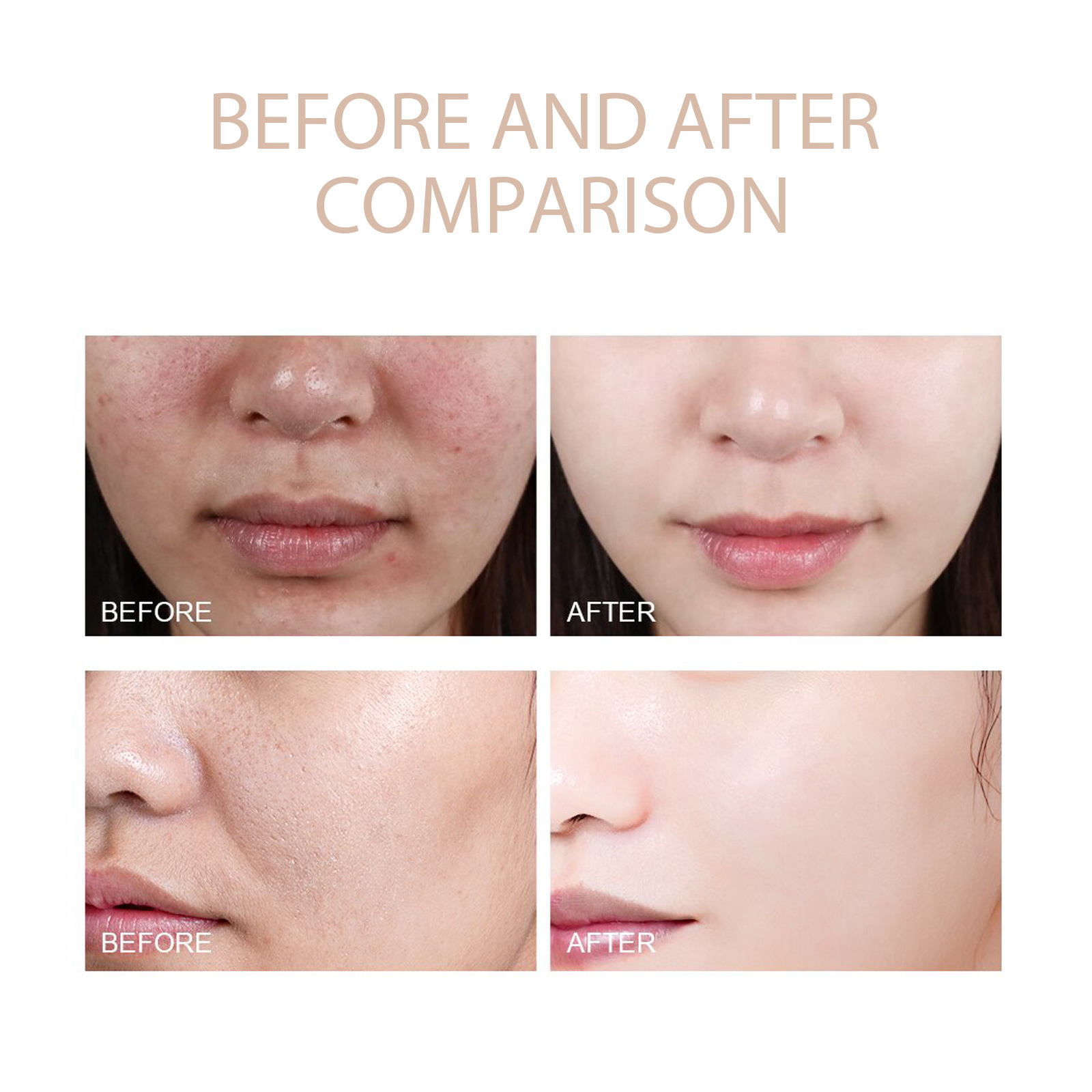 Face Cream & Lotion Purifying Exfoliating Gel for Dirt Cleaning Pores Shrinking Dredging Skin Blackhead Pimple Remover