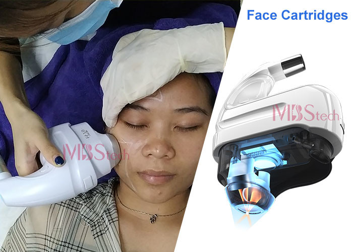 5D Ice High Intensity Focused Ultrasound Machine For Facial Lifting