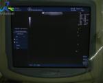 GE 7L Transducer Guided Ultrasound Biopsy SS 90 Days Warranty