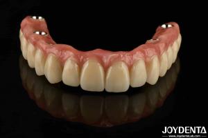 Wholesale Custom Titanium Malong Dental Hybrid Bridge Corrosion Resistance Adjustable from china suppliers