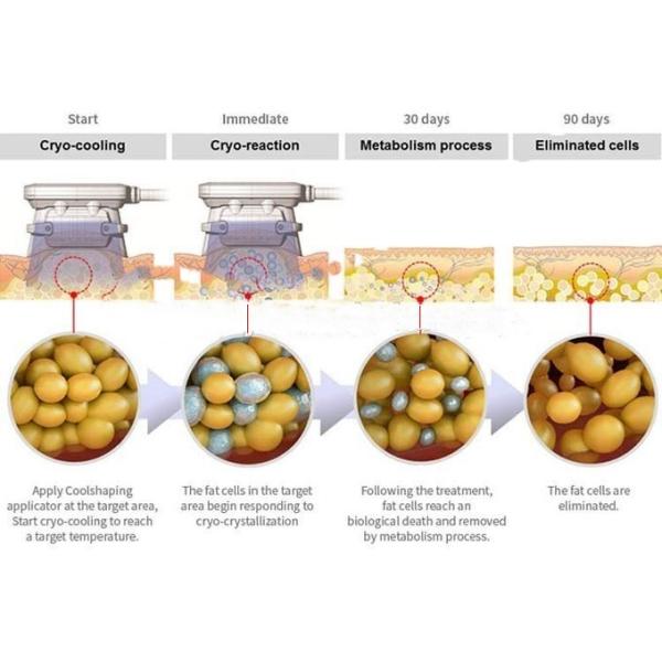 Medical CE TUV Fat Freezing Machine For Home With 4 Handles High Efficiency