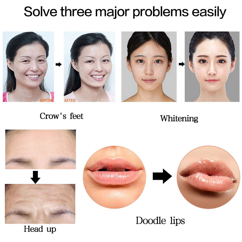 0.3ml Hyaluron Pen Lip Filler Injection Atomizer high Pressure Hyaluronic  acid Pen No Needle Mesotherapy gun for wrinkle removal - buy at the price  of $43.20 in aliexpress.com | imall.com
