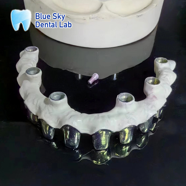 Universal Compatibility Metal Malo Bridge With Pure Titanium Frame