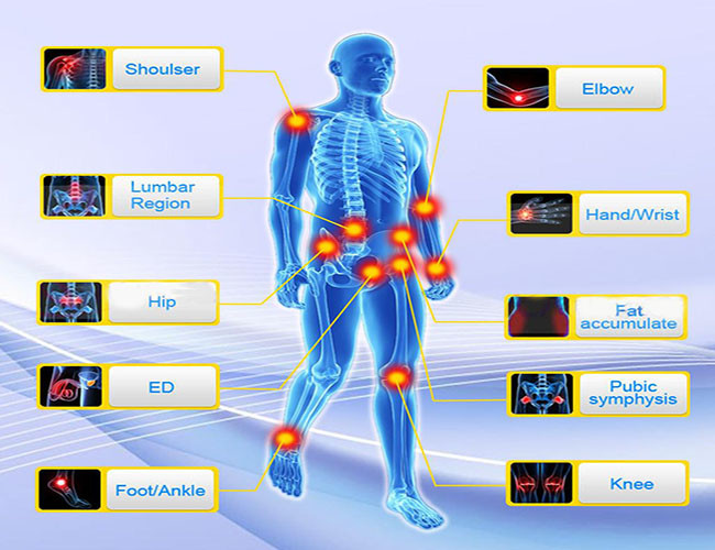 EMS Shockwave Therapy Machine