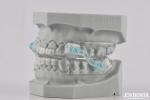 Silicone Anti Snoring Mouthpiece Stop Snoring Dental Appliance Comfortable