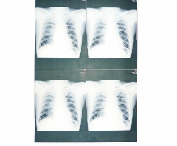 Wearable White Base Medical X Ray Films , Medical Imaging X-ray Paper Film