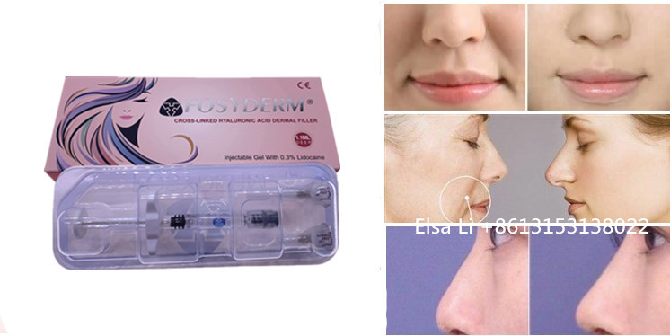1ml 2ml cosmetic dermal filler For Deep Wrinkles HA Gel Injection CE